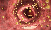 Il nuovo super farmaco per sconfiggere il colesterolo