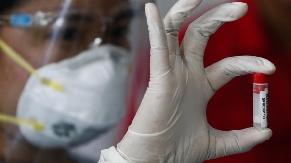 Covid: se il vaccino funziona lo dice il test