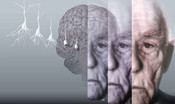Fasci di luce per studiare i segreti del cervello