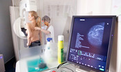 L'anticorpo monoclonale che blocca le metastasi ossee nel cancro al seno