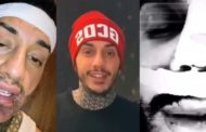 Ennesimo ritocchino per Francesco Chiofalo. Il web lo batosta: 