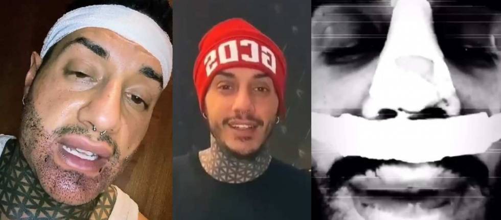 Ennesimo ritocchino per Francesco Chiofalo. Il web lo batosta: 