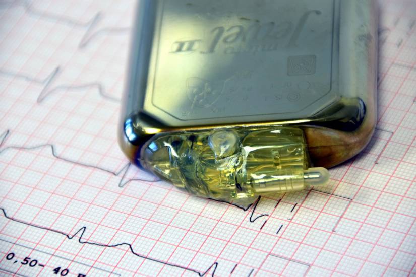 Pacemaker, così smartphone e fitness tracker ne alterano il funzionamento