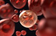 Aneuploidia, scoperto un possibile bersaglio contro il cancro