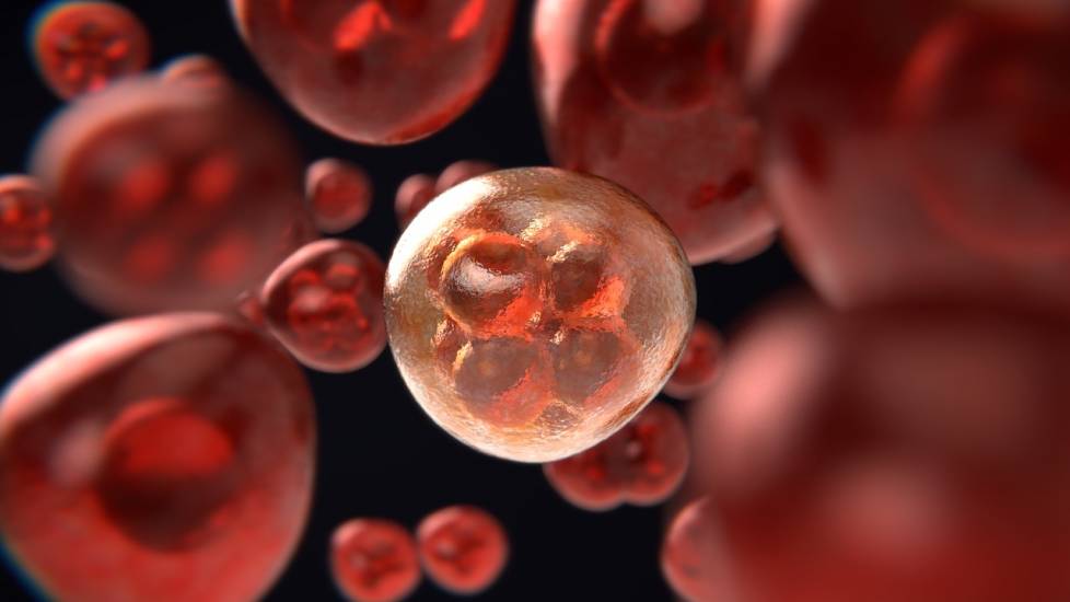 Aneuploidia, scoperto un possibile bersaglio contro il cancro