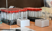 Arriva un nuovo test sierologico che misura gli anticorpi Covid 