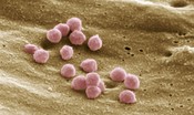 Il paziente zero Hiv potrebbe essere un soldato della prima guerra mondiale