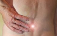 Sciatica, come curarla con i rimedi naturali