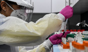Un paziente immunosoppresso ha sviluppato mutazioni dopo la terapia con il plasma