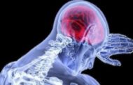 TIA o mini-ictus: ecco perché bisogna intervenire subito per evitare danni al cervello