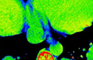 Scoperti i meccanismi chiave dell'origine delle metastasi