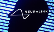 Autorizzata la sperimentazione degli impianti cerebrali Neuralink 
